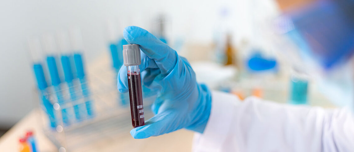 How Long Does Diazepam Last? Duration and Drug Testing Detection Times