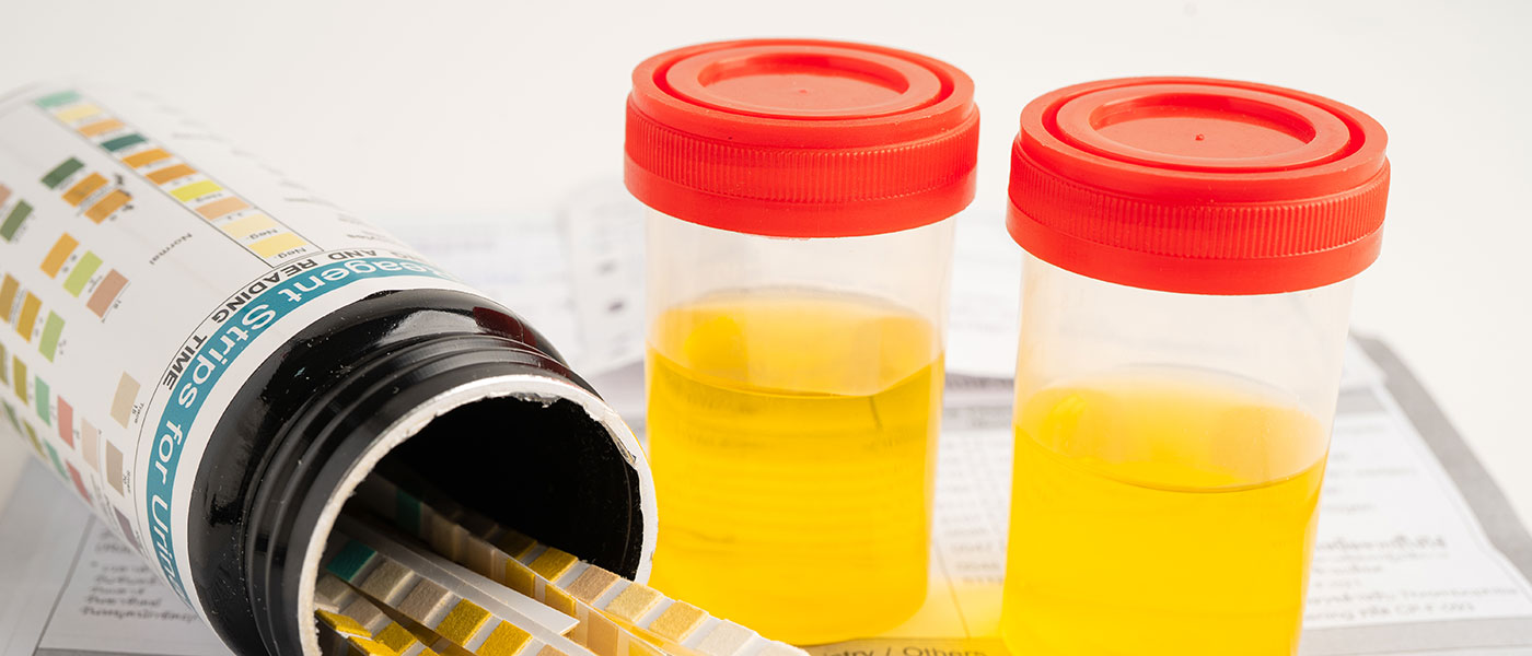 How Long Does Lisdexamfetamine Stay in Your System?